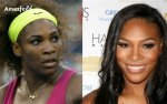 Serena Williams' Face Surgery Journey