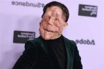 Understanding Adam Pearson's Girlfriend: a Deep Dive into His Personal Life